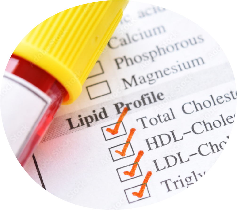 lipidsprechstunde